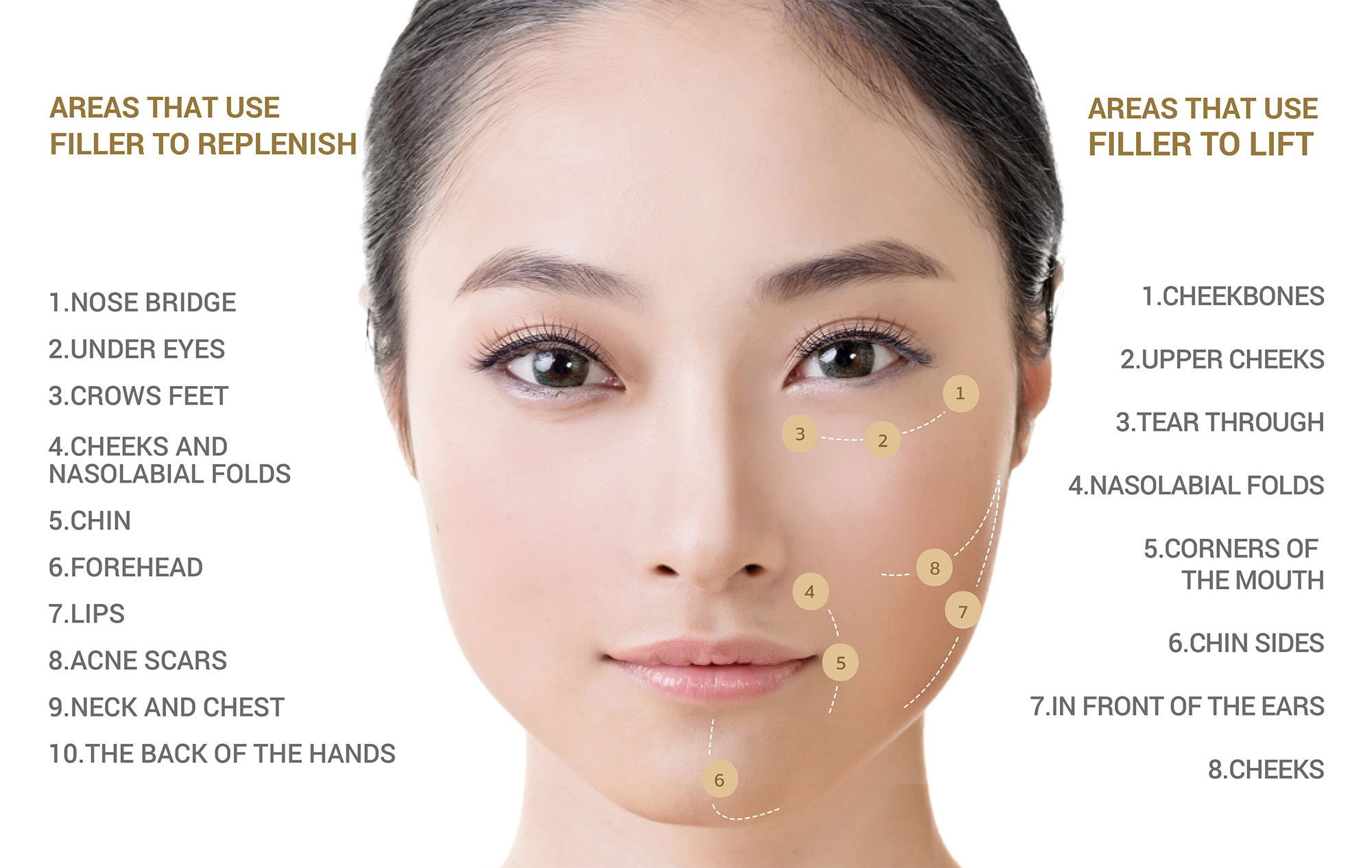 Areas that use filler