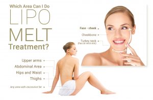 Which area can I do Lipo Melt Treatment